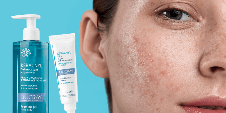BLEMISH TREATMENT - Reduces the appearance of imperfections 