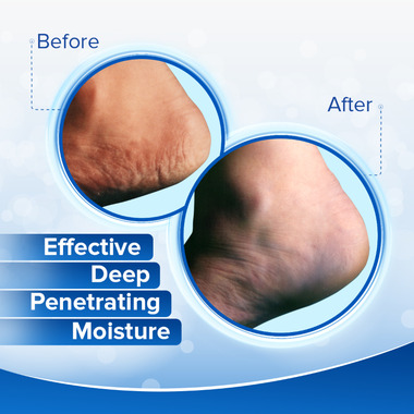 Buy Dermal Therapy Heel Care at Well.ca 